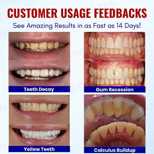 AEXZR® Baking Soda Oral Health Toothpaste