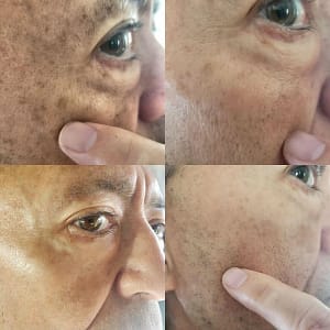 AQA™ Melanin Correcting Facial Serum