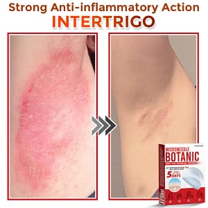 LOVILDS® MicroNeedle Botanic Skin Tag Removal Patch