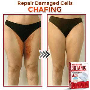 LOVILDS® MicroNeedle Botanic Skin Tag Removal Patch