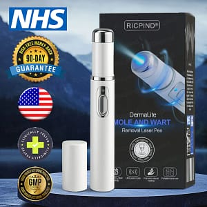 RICPIND® DermaLite Mole and Wart RICPIND® DermaLite Mole and Wart Removal Laser PenRemoval Laser Pen