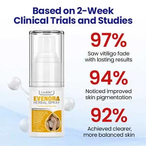 Lovilds® Evenora Vitiligo Herbal Spray