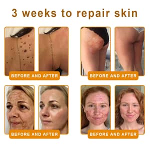 Cougex® “Dermal Gold” Botulin Bee Venom Skin Restoration Cream