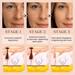 Luhaka®️ Purifying Exfoliating Gel for Acanthosis Nigricans