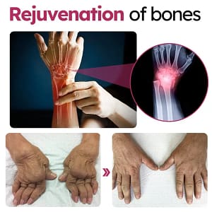 Slimoly™ Advanced Joint & Bone Renewal Cream