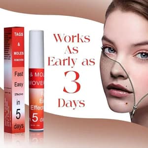 Fivfivgo™ WipeOff Tags & Mole Remover