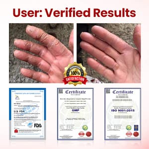 Yagoo® VitaGluco Diabetic Care Cream