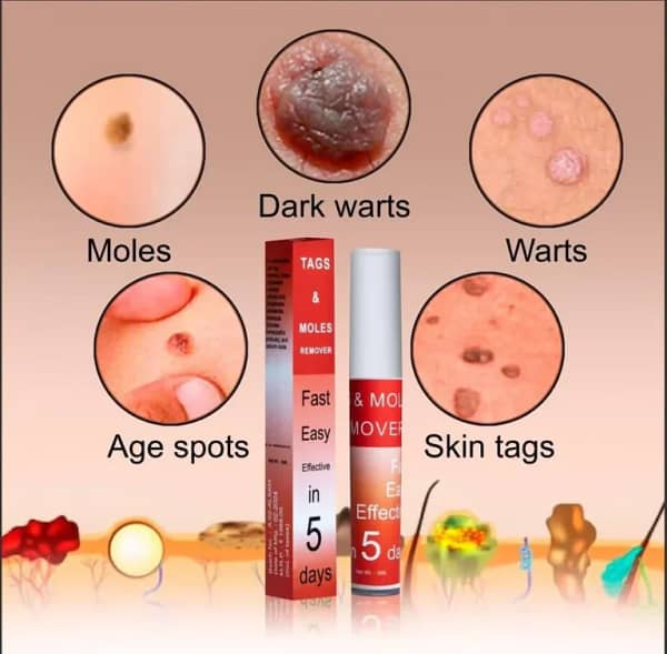 Fivfivgo™ WipeOff Tags & Mole Remover