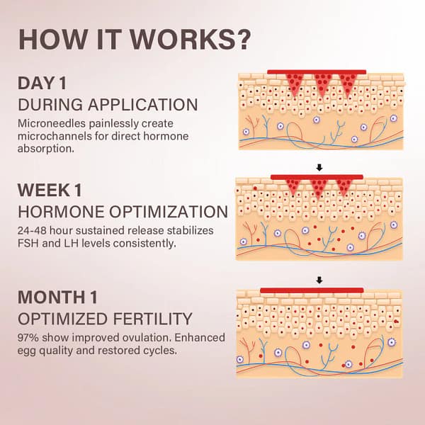 Oveallgo® FertiliPatch Microneedle Fertility Enhancement System