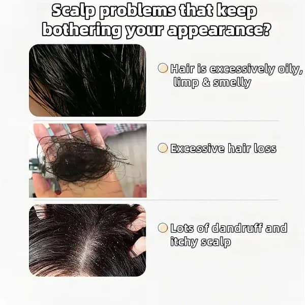 LOVILDS™ Ginseng Ginger Anti-Hair Loss Shampoo 300ml