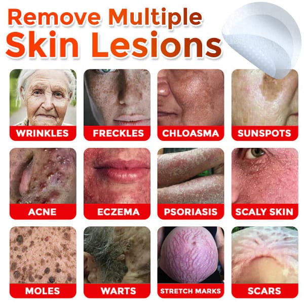LOVILDS® MicroNeedle Botanic Skin Tag Removal Patch
