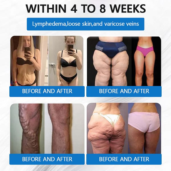 LERCEA® SMGT-GLP-1 Tirzepatide & Collagen Nano Microneedle Weight Loss Patch