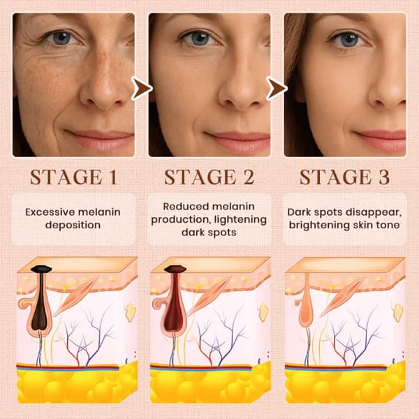 Luhaka®️ Purifying Exfoliating Gel for Acanthosis Nigricans