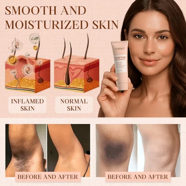 Luhaka®️ Purifying Exfoliating Gel for Acanthosis Nigricans