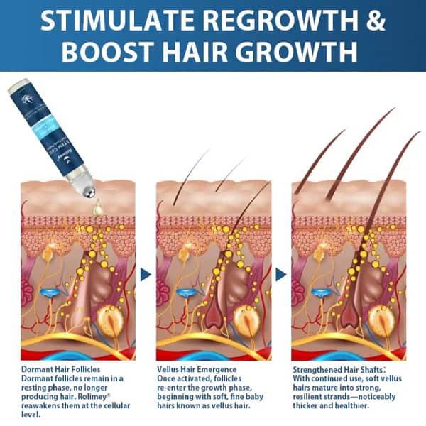 Rolimey®️ Stem Cell Hair Cycle Roller