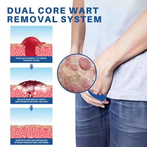 Fivfivgo® Advanced HPV & Rash Relief Genital Foam