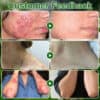 Zvoevo® Tea Tree Oil Skin Treatment Cream