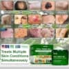 AEXZR® Tea Tree Oil Skin Treatment Cream