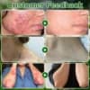 AEXZR® Tea Tree Oil Skin Treatment Cream