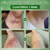 Zvoevo® Tea Tree Oil Skin Treatment Cream
