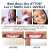 ATTDX® Laser Smile Care Device