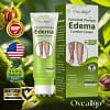 Oveallgo® VeinoRoll Therapy Edema Comfort Cream