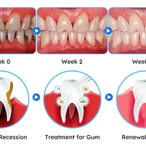 LOVILDS™ Gum Care Gel – Restore & Strengthen Your Gums