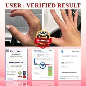 ALISANDA® GlucoseGuard Skin Rescue Cream