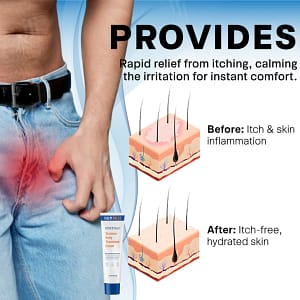 Fivfivgo® Scrotum Itchy Treatment Cream