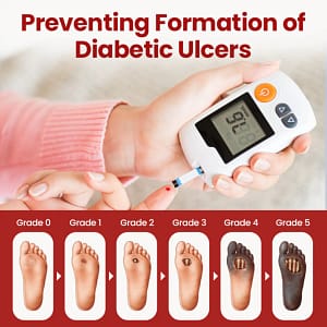 Timilk® VitaGluco Diabetic Care Cream