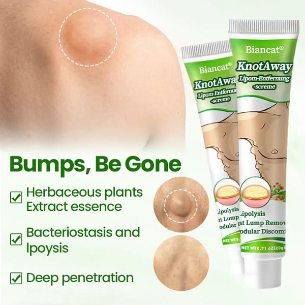 Biancat® KnotAway Lipoma Removal Cream