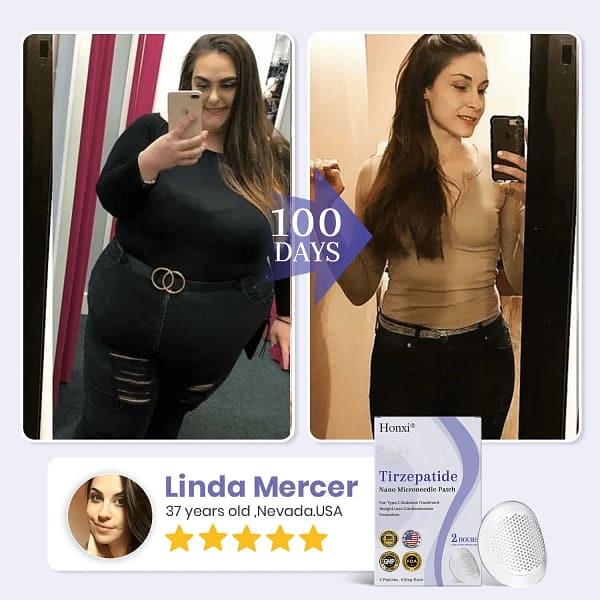 Tirzepatide Namo Microneedle Patch