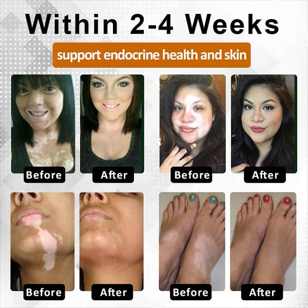 Fivfivgo® VitiBee Skin Rebalancing Cream