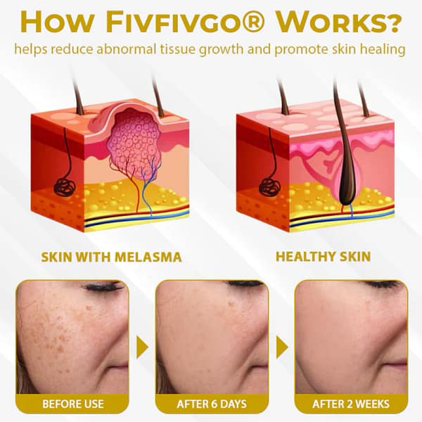 Fivfivgo® VitiBee Skin Rebalancing Cream - Image 8