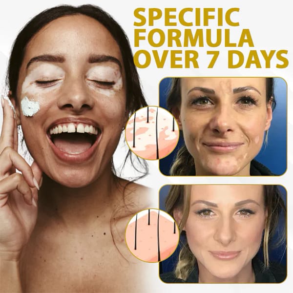 Fivfivgo® VitiBee Skin Rebalancing Cream - Image 9