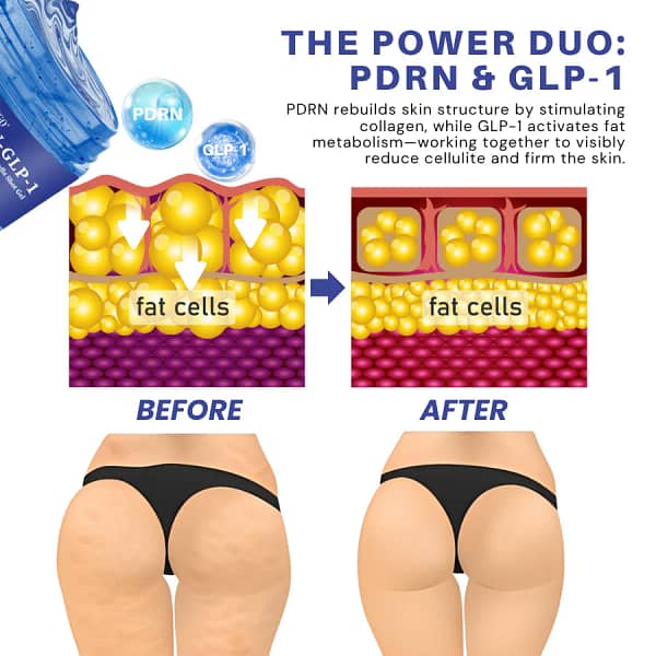 Fivfivgo® PDRN-GLP-1 Cellulite Targeting Reedle Shot Gel - Image 3