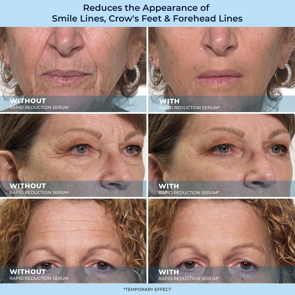 Plexadern™ 60-Second Anti-Aging Serum