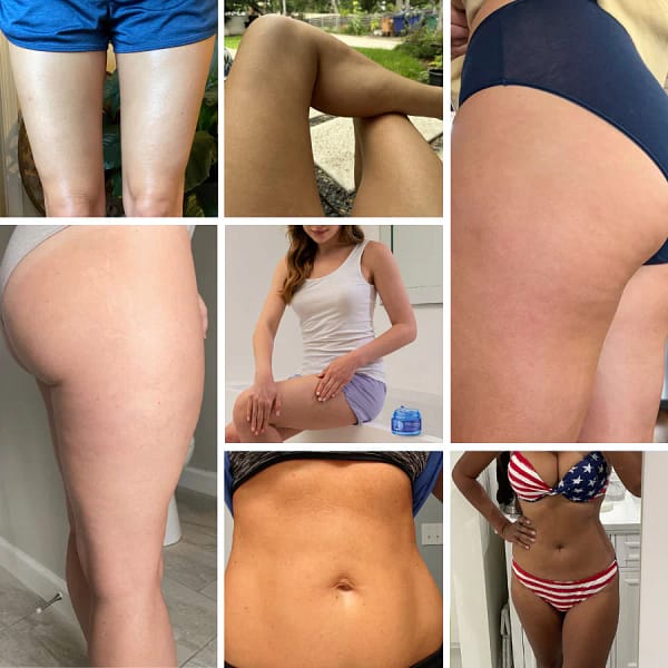 Fivfivgo® PDRN-GLP-1 Cellulite Targeting Reedle Shot Gel - Image 9