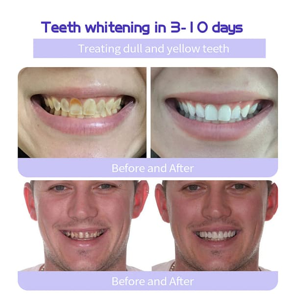 Best Deal ODALIT™ TeethRestoration Mineral Powder - Image 9