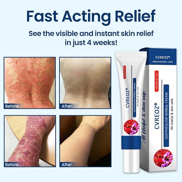 CVREOZ® SootheGlow Herbal Cream - Image 3