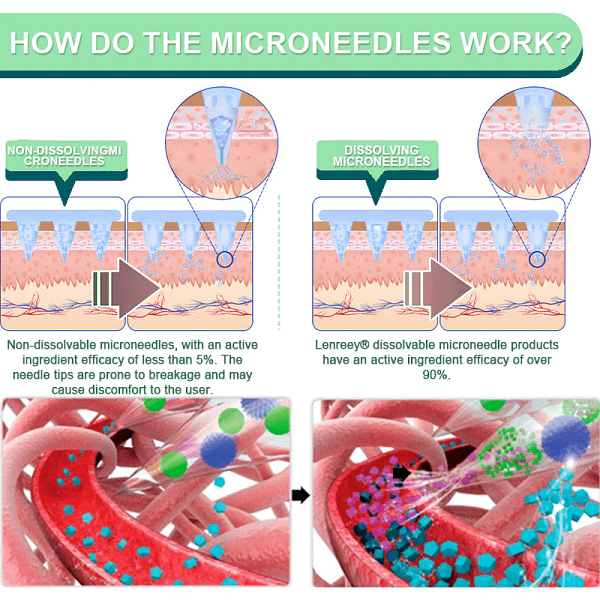 Lercea® NIDDK-Tirzepatide Slimming & Health Nano Microneedle Patch - Image 6