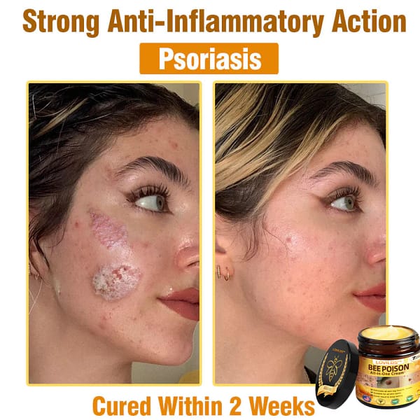 LOVILDS™ Bee Poison All-in-One Cream