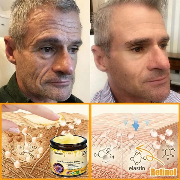 Laozik™ Skin Restoration Cream - Image 5