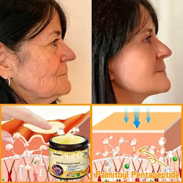 Laozik™ Skin Restoration Cream - Image 4