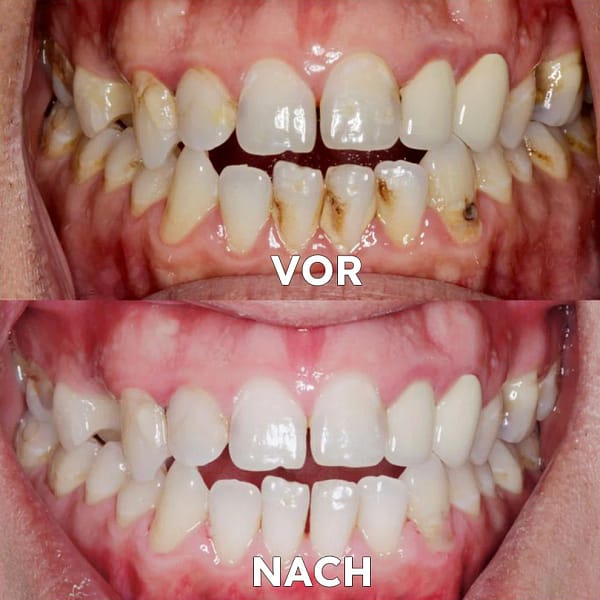 Seurico™ Gum Repair & Oral Health Powder