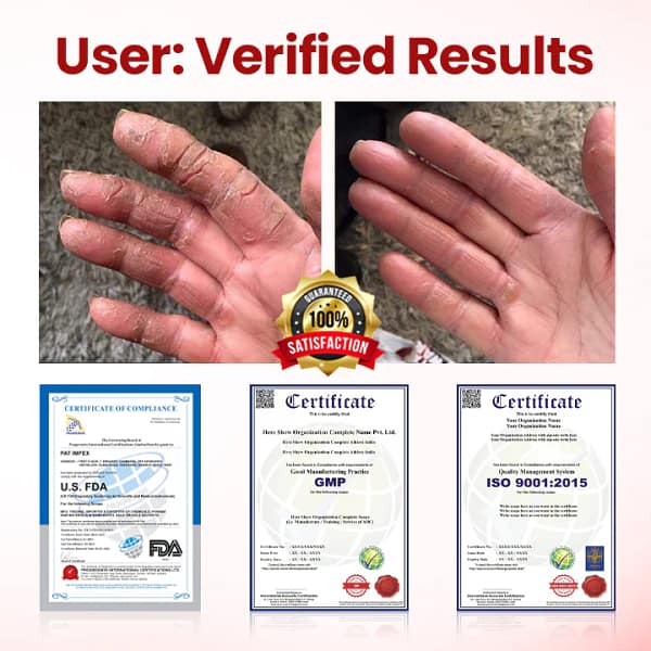 Yagoo® VitaGluco Diabetic Care Cream