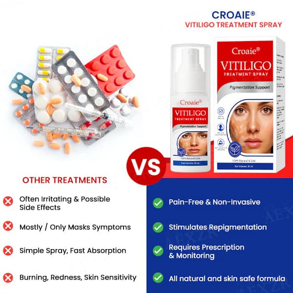 Croaie® Vitiligo Treatment Spray - No allergies