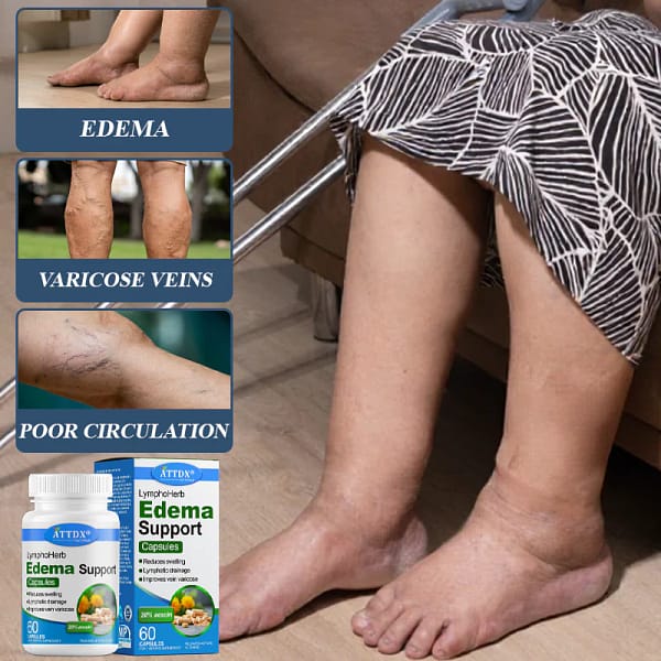 ATTDX® LymphoHerb Edema Support Capsules