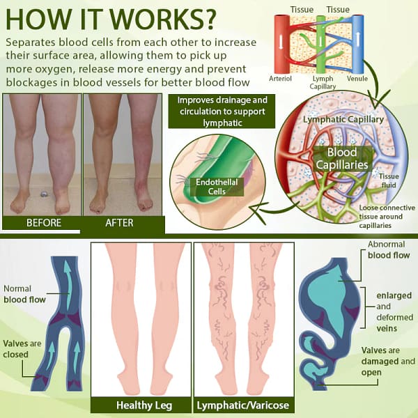 ATTDX® SwellSoothe Lymphatic Cream