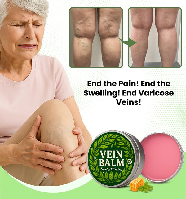 VeinBalm™ Varicose Vein Ointment | Reduce Varicose Veins by 95% in 7 Days!